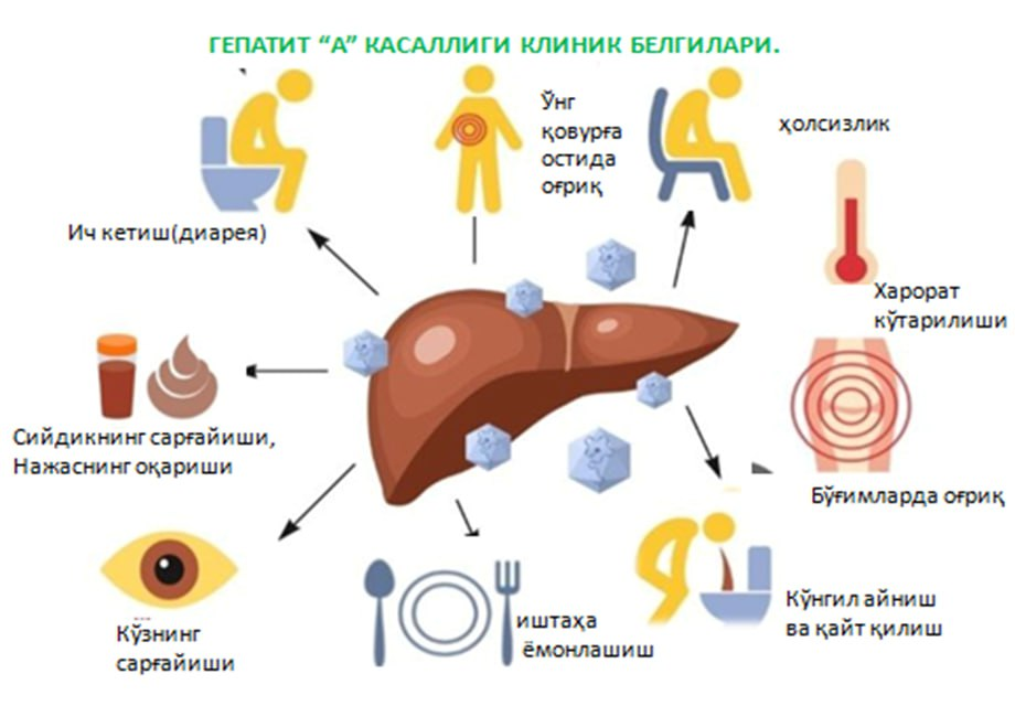 Вирусли гепатит "А"