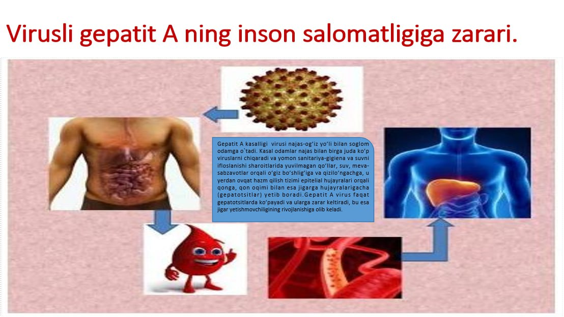 Gepatit A (Botkin kasalligi) — RNK-virus bo’lib, Picornavirus oilasiga, Enterovirus sinfiga mansub, o’tkir virusli jigar shikastlanishiga olib keladi.