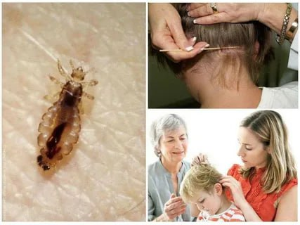 Ehtiyot bo‘ling –pedikulyoz.