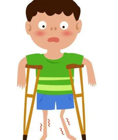 Poliomiyelit – o‘ta yuqumli kasallikdir.