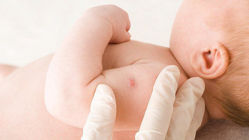 BSJ vaksinasi qanchalik muhim?